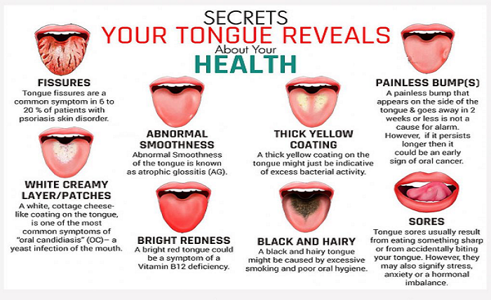 tongue health chart